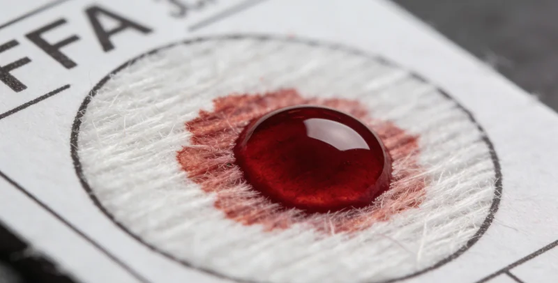 医生在灯箱前查看患者的肺部CT