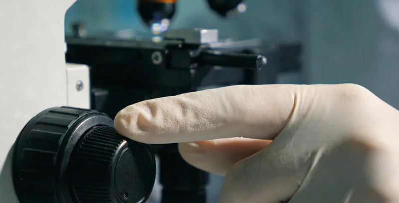 医生在灯箱前查看肺部CT影像，