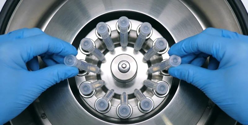 家庭获得检测报告并与专业人士沟