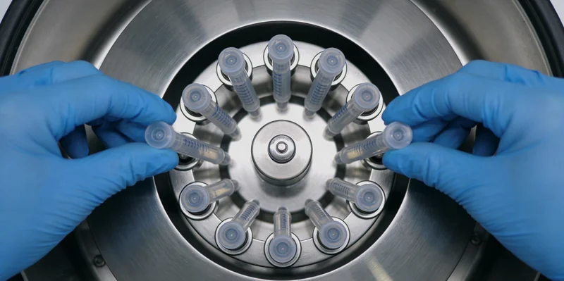 医护人员正在进行静脉采血，试管