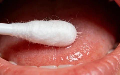 通化腹腔积液mNGS基因检测：2026精选机构全名单与避坑指南（本地查询）