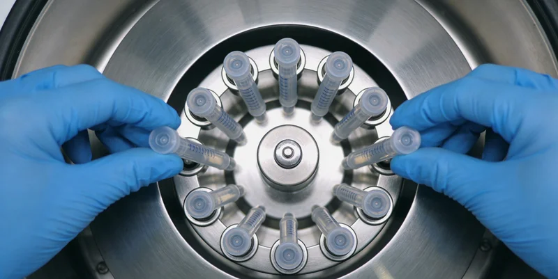 巨细胞病毒结构模型示意图,展示