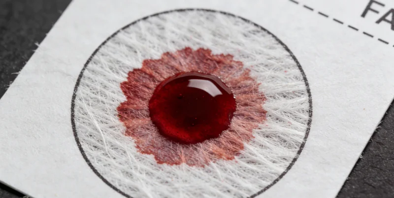 医护人员正在为咨询者进行鼻咽拭