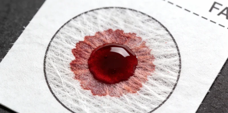 专业护士正在为患者规范采集用于