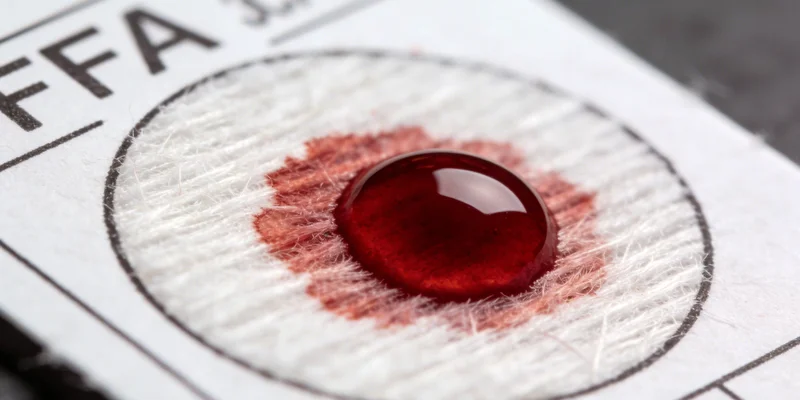 医护人员正在规范采集血液样本,