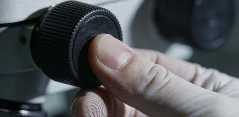 一位曲靖的医生正在仔细分析医学