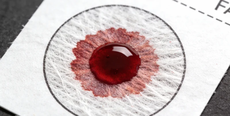 医护人员使用专用拭子进行无痛样