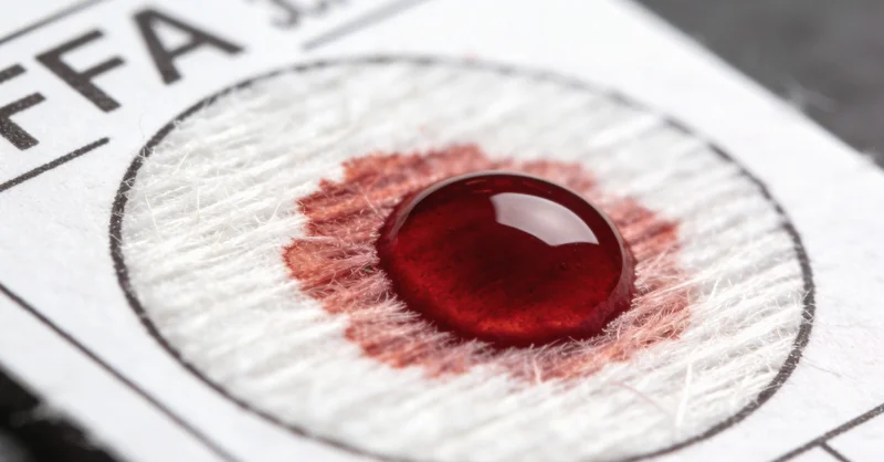 贴有标签的胸腔积液样本管,放置