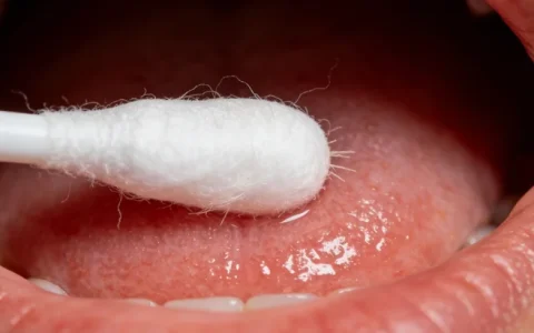 黄冈mNGS检测时间基因检测机构名单