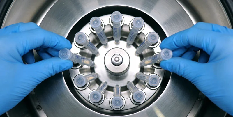 实验室离心机正在处理待检测的样