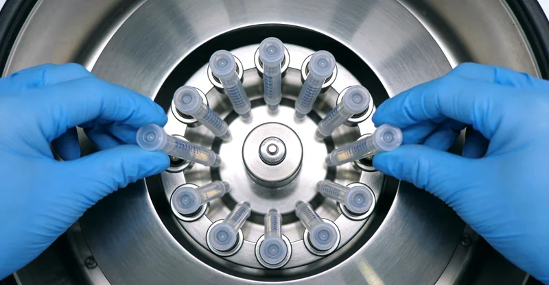 瑞安遗传咨询提示Holt-Or