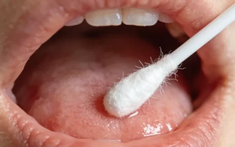 峨眉山家族性胸主动脉瘤基因检测机构地址一览表