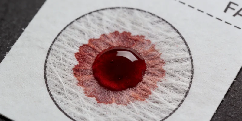 广德医院进行基因检测静脉血样本