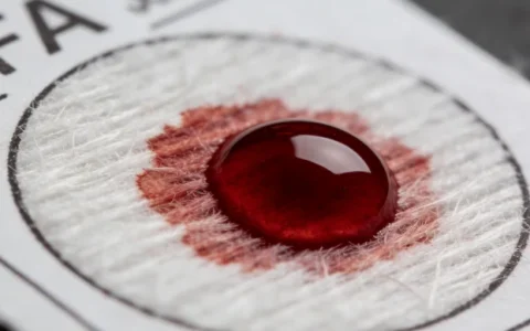 曲靖GLA基因检测中心信息查询