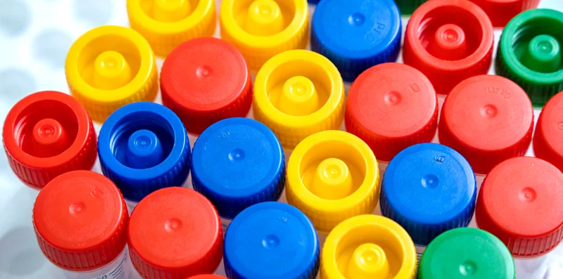 邵阳医生分析TBX5基因检测报