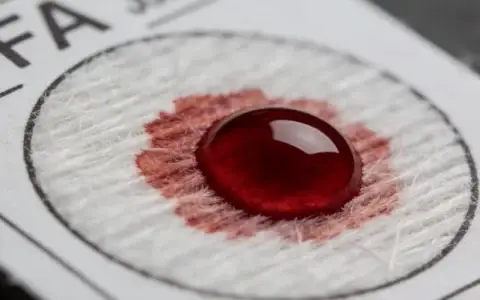 什邡MYH11基因检测什么地方做