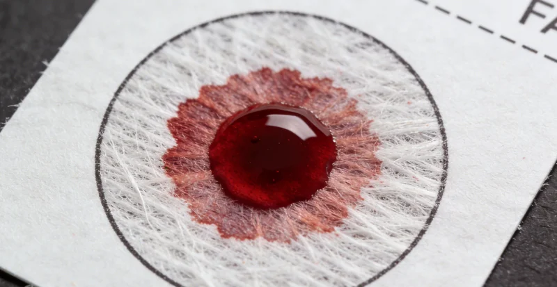 海南州医院护士进行无创血液样本