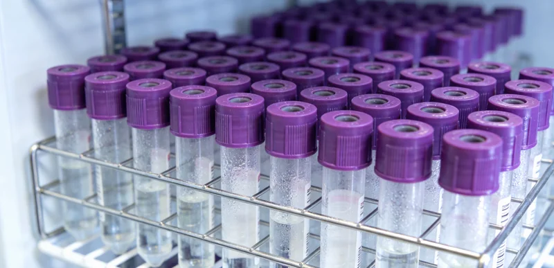 淮北家庭健康运动预防心血管病