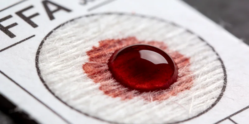 滦州本地医院静脉采血进行基因检