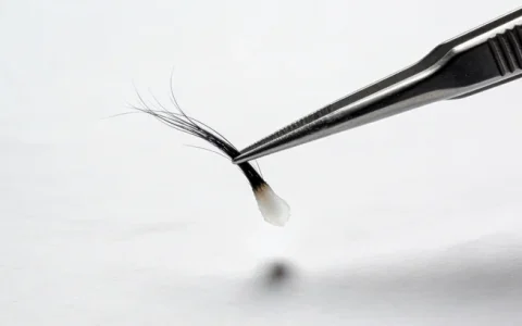 泸州布鲁加达综合征基因检测本地人都推荐的机构（口碑榜）