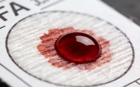 吕梁PKP2基因检测可靠中心最新名单