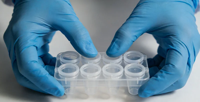 松滋心肌淀粉样变基因检测报告解