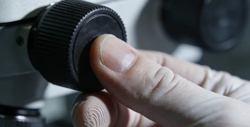 Brugada综合征基因检测高