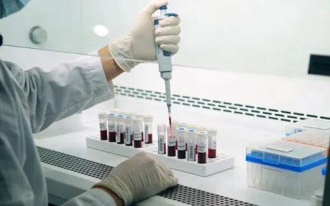 汝州恶性周围神经鞘瘤风险基因检测机构名录最新汇总