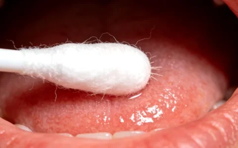 株洲LDLR基因检测正规机构去哪找？