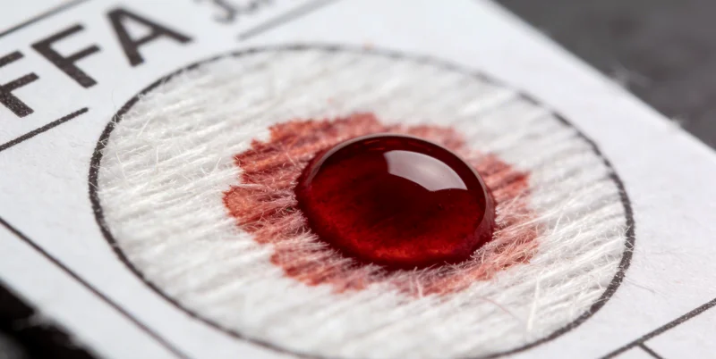 黔南州医院护士进行血液样本采集