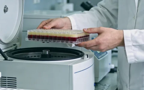 双鸭山神经纤维瘤病I型基因检测机构怎么选？排名推荐