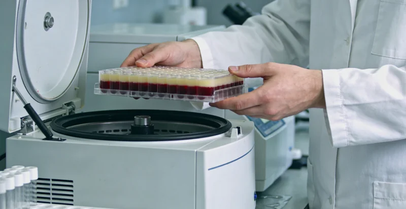 双鸭山家长观察孩子皮肤上的咖啡