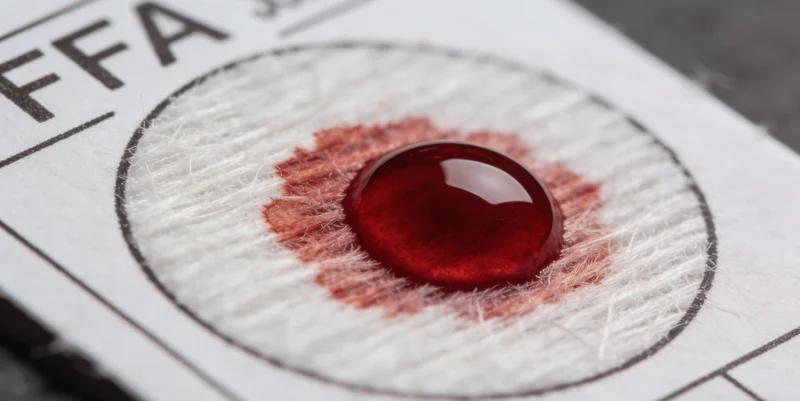 大石桥市民进行ATTR基因检测