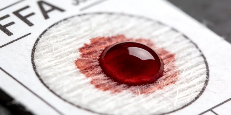 瓦房店基因检测采血流程示意