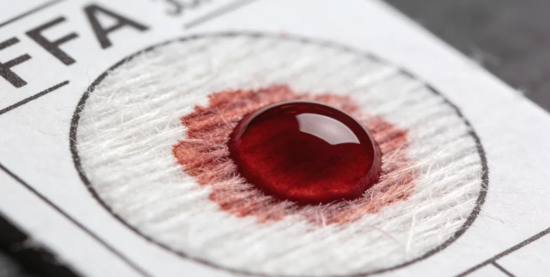 丽江医院护士进行静脉采血用于基