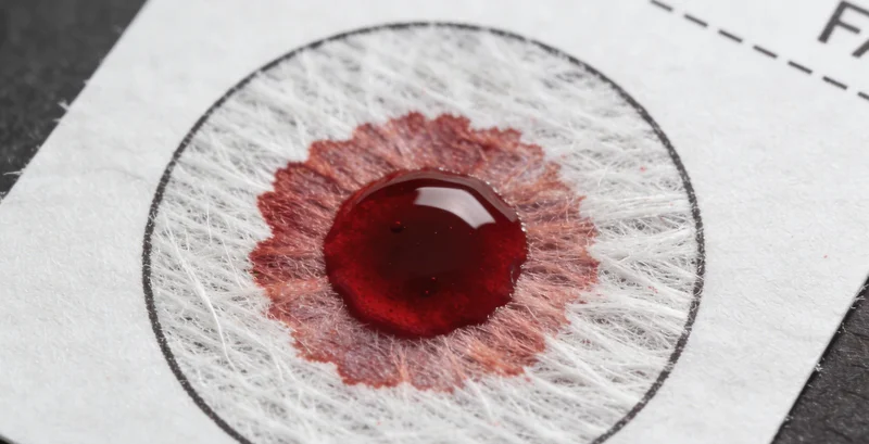 广州遗传咨询师向家庭解读基因检