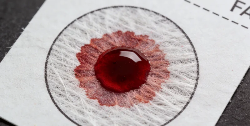 兴仁基因检测采样与运输流程示意