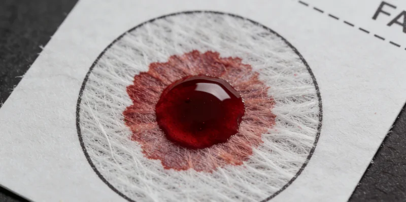 丽江限制型心肌病基因检测抽血采