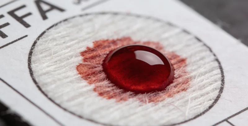 高邮本地医疗点进行基因检测血液