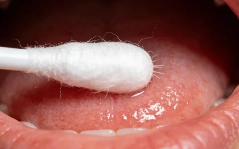 邳州RYR2基因检测官方备案机构推荐