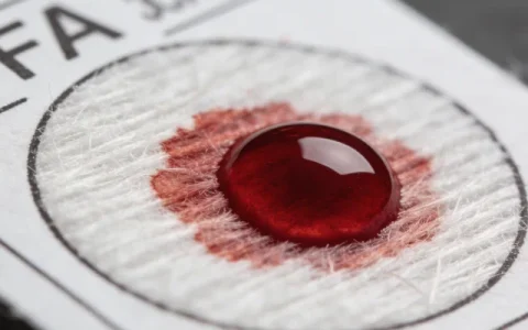 阿尔山遗传性乳腺癌基因检测正规机构服务推荐