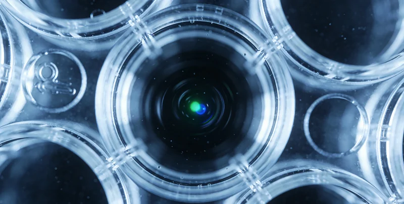 莫旗黑斑息肉综合征典型手部色素