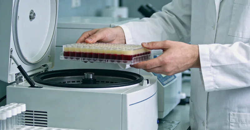 林州健康管理-定期肠镜检查示意