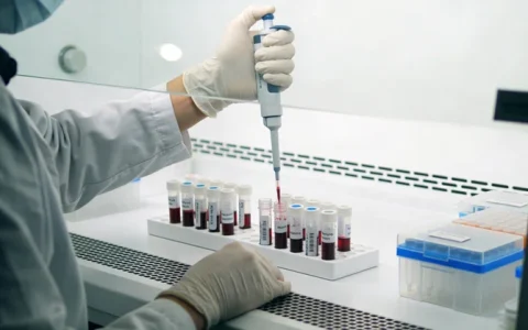 义马PJS基因检测正规机构名单（直接收藏）