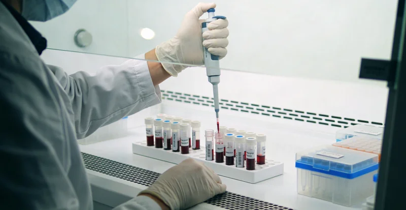 五指山医院内镜中心进行早期肠癌