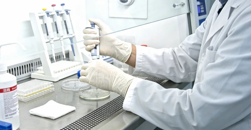 昆明地区小叶性乳腺癌病理细胞形