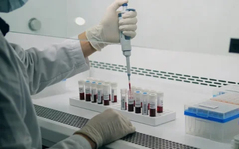 眉山神经鞘瘤病基因检测机构在哪？