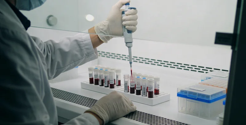 眉山神经鞘瘤病MRI影像示意图