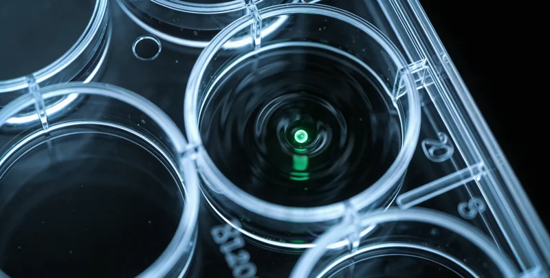 会理人展示嘴唇周围典型黑色素斑