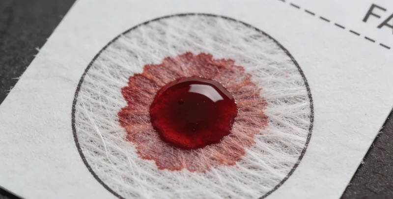 昆明市民在医院心内科咨询心电图